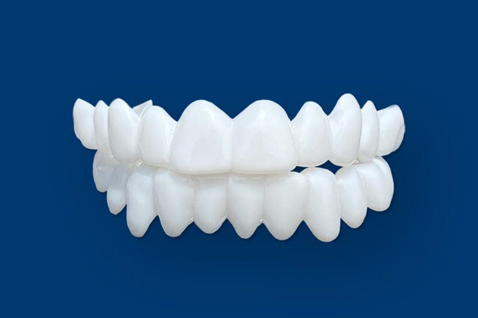 Veneers