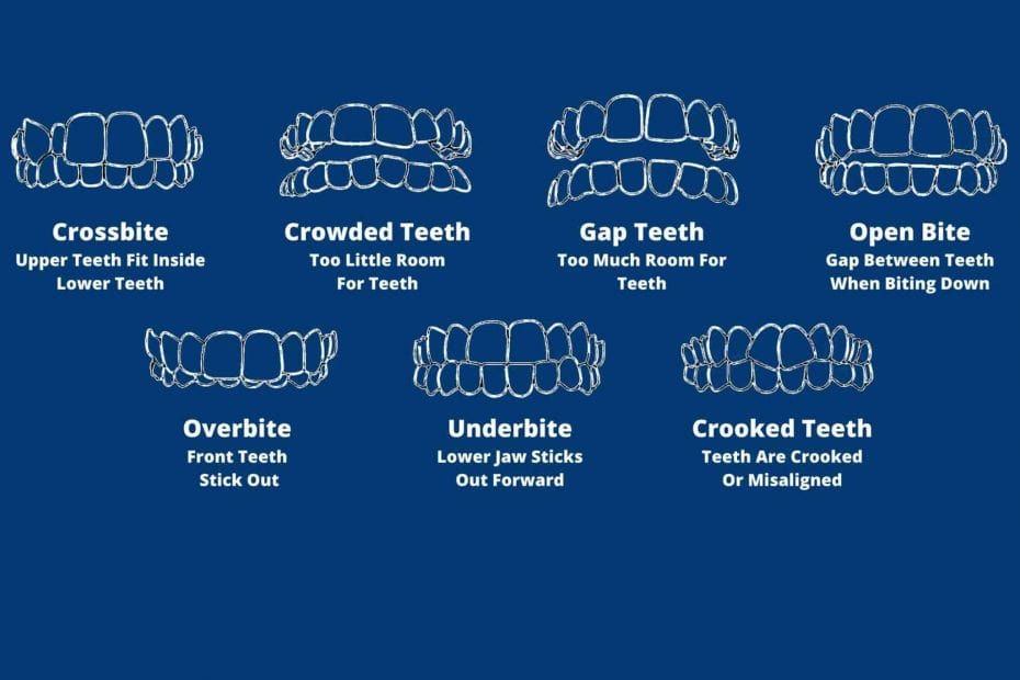 Teeth Problems Vector